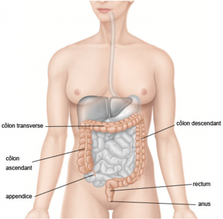 Cancer colorectal - Colon Cancer colorectal - Colon